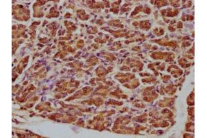 IHC image of ABIN7148801 diluted at 1:100 and staining in paraffin-embedded human pancreatic tissue performed on a Leica BondTM system. (ATF5 抗体  (AA 1-282))