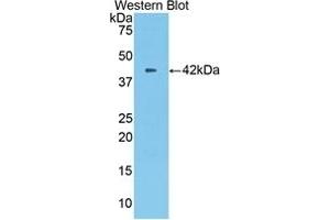 Detection of recombinant CPB2 using Polyclonal Antibody to Carboxypeptidase B2 (CPB2) (CPB2 抗体  (AA 113-422))