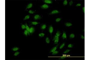 Immunofluorescence of monoclonal antibody to UBE3A on HeLa cell. (ube3a 抗体  (AA 51-150))