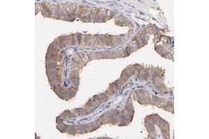 Immunohistochemical staining of human fallopian tube with STON2 polyclonal antibody  shows moderate cytoplasmic positivity in glandular cells at 1:50-1:200 dilution. (Stonin 2 (STON2) 抗体)