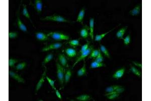Immunofluorescent analysis of Hela cells using ABIN7165698 at dilution of 1:100 and Alexa Fluor 488-congugated AffiniPure Goat Anti-Rabbit IgG(H+L) (PKC beta 抗体  (AA 517-643))