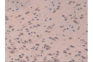 Detection of EIF3A in Mouse Brain Tissue using Polyclonal Antibody to Eukaryotic Translation Initiation Factor 3A (EIF3A) (EIF6 抗体  (AA 622-848))