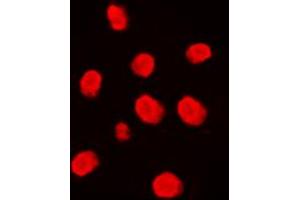 Immunofluorescent analysis of MEKK3 staining in Raji cells. (MAP3K3 抗体  (Center))