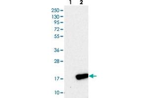Western blot analysis of Lane 1: Negative control (vector only transfected HEK293T lysate), Lane 2: Over-expression Lysate (Co-expressed with a C-terminal myc-DDK tag (~3. (PLGRKT 抗体)