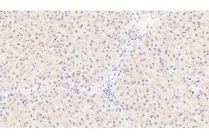 Immunohistochemistry (IHC) image for anti-Syndecan Binding Protein (Syntenin) 2 (SDCBP2) (AA 1-292) antibody (ABIN7427600)