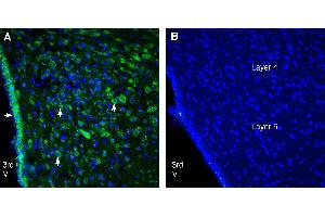Expression of CCKBR in rat hypothalamus.
