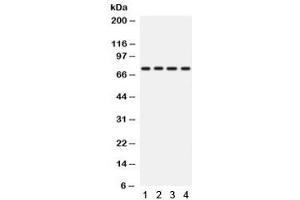 Western blot testing of human 1) A431, 2) A549, 3) HeLa and 4) SKOV lysate with PKC eta antibody. (PKC eta 抗体  (AA 30-389))