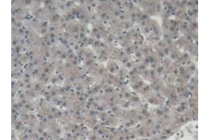 DAB staining on IHC-P; Samples: Porcine Liver Tissue (ORM1 抗体  (AA 2-171))