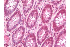 Anti-BRAF / B-Raf antibody IHC staining of human colon.