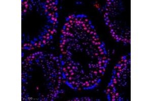 Immunofluorescence of paraffin embedded mouse testis using SNRNP200 (ABIN7075632) at dilution of 1: 650 (250x lens) (SNRNP200 抗体)