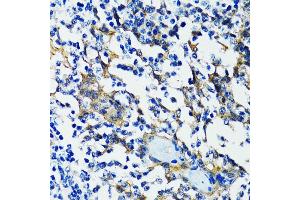 Immunohistochemistry of paraffin-embedded human tonsil using HD antibody (ABIN6133742, ABIN6141675, ABIN6141678 and ABIN6213911) at dilution of 1:100 (40x lens).