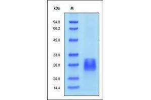 Human Activin RIIB, His Tag on SDS-PAGE under reducing (R) condition. (ACVR2B Protein (AA 19-137) (His tag))