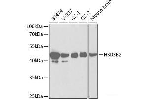 Western blot analysis of extracts of various cell lines using HSD3B2 Polyclonal Antibody at dilution of 1:1000. (HSD3B2 抗体)