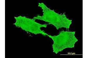 Immunofluorescence of monoclonal antibody to SMC1B on HeLa cell. (SMC1B 抗体  (AA 551-660))