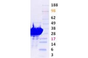 Validation with Western Blot (PAK1 Protein (Transcript Variant 1))