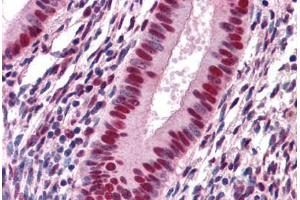 Human Uterus: Formalin-Fixed, Paraffin-Embedded (FFPE) (SAFB 抗体  (AA 111-201))