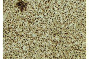 ABIN6273062 at 1/100 staining Mouse liver tissue by IHC-P. (OTUD7B 抗体  (C-Term))