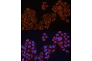 Immunofluorescence analysis of HeLa cells using  antibody (ABIN6127341, ABIN6136780, ABIN6136781 and ABIN6220209) at dilution of 1:100. (ALDH6A1 抗体  (AA 326-535))
