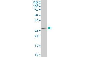 CDK4 monoclonal antibody (M06), clone 6D7. (CDK4 抗体  (AA 211-303))