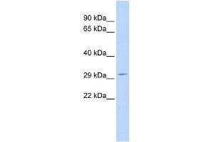 SCOTIN antibody used at 1 ug/ml to detect target protein. (SHISA5 抗体  (Middle Region))