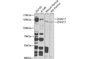 ZNF217 抗体  (AA 1-190)