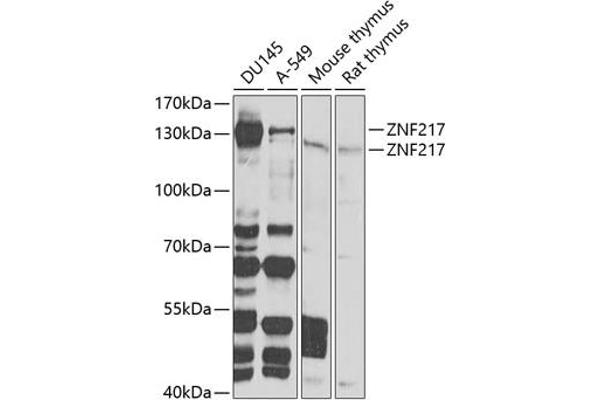 ZNF217 anticorps  (AA 1-190)