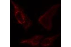 ABIN6276392 staining  COLO205 cells by IF/ICC. (STEAP3 抗体  (N-Term))