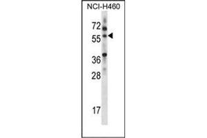 Western blot analysis of MINPP1 Antibody (C-term) in NCI-H460 cell line lysates (35ug/lane). (MINPP1 抗体  (C-Term))