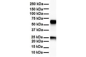 Western Blotting (WB) image for anti-Solute Carrier Family 33 Member 1 (SLC33A1) (Middle Region) antibody (ABIN2781611)