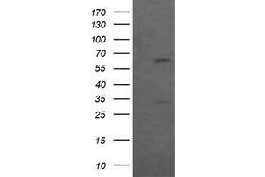 Image no. 2 for anti-Chaperonin Containing TCP1, Subunit 8 (Theta)-Like 2 (CCT8L2) antibody (ABIN1497482) (CCT8L2 抗体)