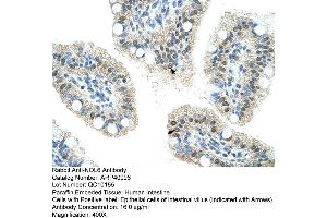Rabbit Anti-NOL6 Antibody  Paraffin Embedded Tissue: Human Intestine Cellular Data: Epithelial cells of intestinal villas Antibody Concentration: 4. (Nucleolar Protein 6 抗体  (C-Term))