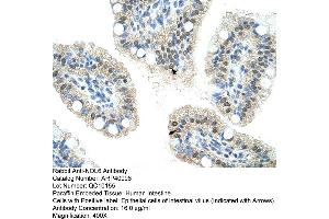Rabbit Anti-NOL6 Antibody  Paraffin Embedded Tissue: Human Intestine Cellular Data: Epithelial cells of intestinal villas Antibody Concentration: 4.