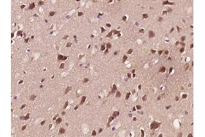 Immunohistochemistry (Paraffin-embedded Sections) (IHC (p)) image for anti-Amyloid beta (A4) Precursor Protein-Binding, Family B, Member 1 (Fe65) (APBB1) (pSer175) antibody (ABIN755797)