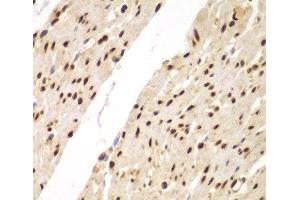 Immunohistochemistry of paraffin-embedded Human colon using SUPT20H Polyclonal Antibody at dilution of 1:100 (40x lens). (FAM48A/P38IP 抗体)