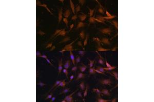 Immunofluorescence (IF) image for anti-Proteasome (Prosome, Macropain) 26S Subunit, Non-ATPase, 13 (PSMD13) (AA 1-250) antibody (ABIN6146337)