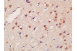 Formalin-fixed and paraffin embedded rat brain labeled with Rabbit Anti-JMJD2B(Thr305) Polyclonal Antibody, Unconjugated  at 1:200 followed by conjugation to the secondary antibody and DAB staining (KDM4B 抗体  (pThr305))