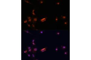 Immunofluorescence analysis of C6 cells using BRC antibody (435) at dilution of 1:100. (BRCA2 抗体  (AA 1-300))