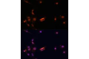 Immunofluorescence analysis of C6 cells using BRC antibody (435) at dilution of 1:100.