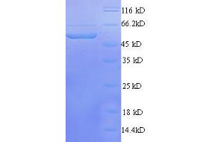 Transcriptional Adaptor 3 (TADA3) (AA 1-238), (partial) protein (GST tag) (TADA3L Protein (AA 1-238, partial) (GST tag))