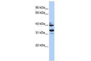 WB Suggested Anti-ZNF550 Antibody Titration:  0.