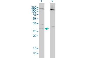 Western Blot analysis of BCL7B expression in transfected 293T cell line by BCL7B monoclonal antibody (M01), clone 6D2. (BCL7B 抗体  (AA 124-202))