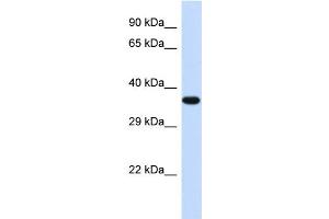 Western Blotting (WB) image for anti-Transducer of ERBB2, 2 (TOB2) (Middle Region) antibody (ABIN2774214) (TOB2 抗体  (Middle Region))
