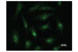 Immunostaining analysis in HeLa cells. (DDX27 抗体)