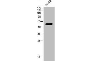 Western Blot analysis of HEPG2 using LPAAT-θ Polyclonal Antibody (AGPAT9 抗体  (C-Term))
