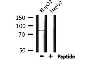 Western blot analysis of extracts from HepG2, using CCNK Antibody. (Cyclin K 抗体  (N-Term))