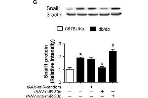 Snail1 is a target of miR-30c. (SNAIL 抗体  (C-Term))