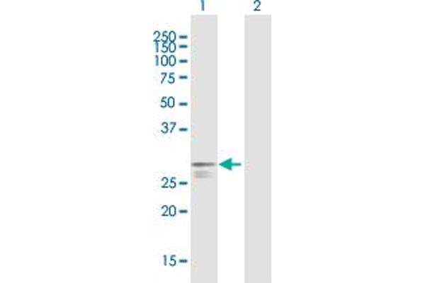 Poly(A) Binding Protein, Cytoplasmic, Pseudogene 2 (PABPCP2) (AA 1-269) 抗体