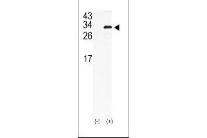 Western blot analysis of GJB6 using rabbit polyclonal GJB6 Antibody using 293 cell lysates (2 ug/lane) either nontransfected (Lane 1) or transiently transfected with the GJB6gene (Lane 2).