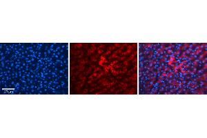 HP (haptoglobin)antibody - N-terminal region          Formalin Fixed Paraffin Embedded Tissue:  Human Liver Tissue    Observed Staining:  Cytoplasm in hepatocytes   Primary Antibody Concentration:  1:100    Secondary Antibody:  Donkey anti-Rabbit-Cy3    Secondary Antibody Concentration:  1:200    Magnification:  20X    Exposure Time:  0. (Haptoglobin 抗体  (N-Term))