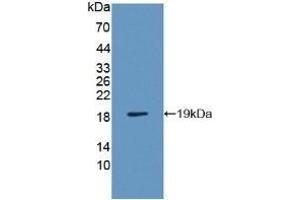 Detection of Recombinant VAPB, Human using Polyclonal Antibody to Vesicle Associated Membrane Protein Associated Protein B (VAPB) (VAPB 抗体  (AA 1-132))